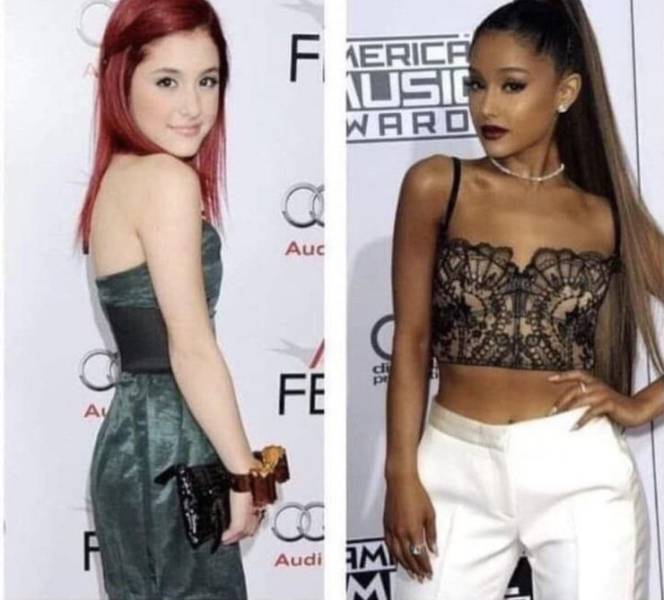 ariana grande before and after - Erice Iusic Ward
