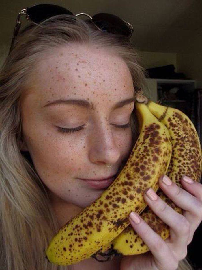 freckles on bananas
