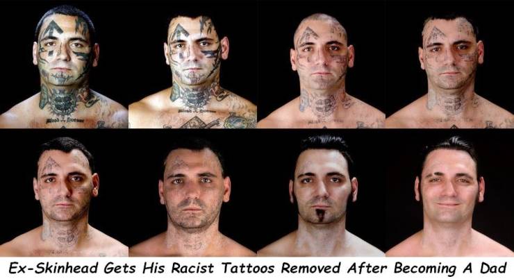 bryon widner - ExSkinhead Gets His Racist Tattoos Removed After Becoming A Dad