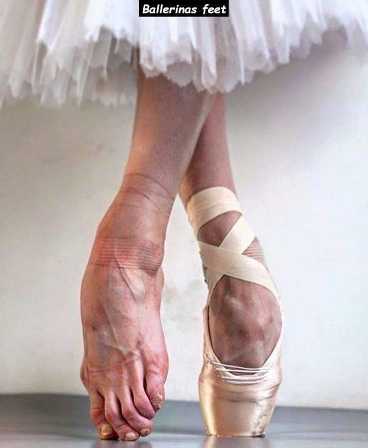 feet look like hands - Ballerinas feet