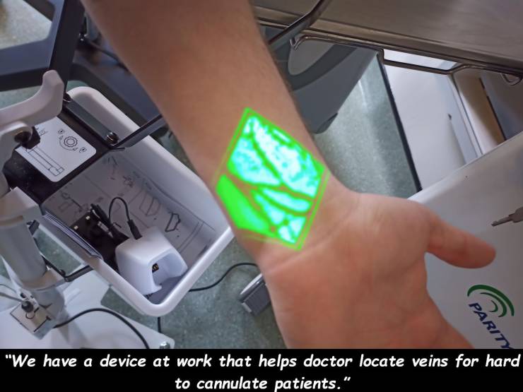 hand - "We have a device at work that helps doctor locate veins for hard to cannulate patients."