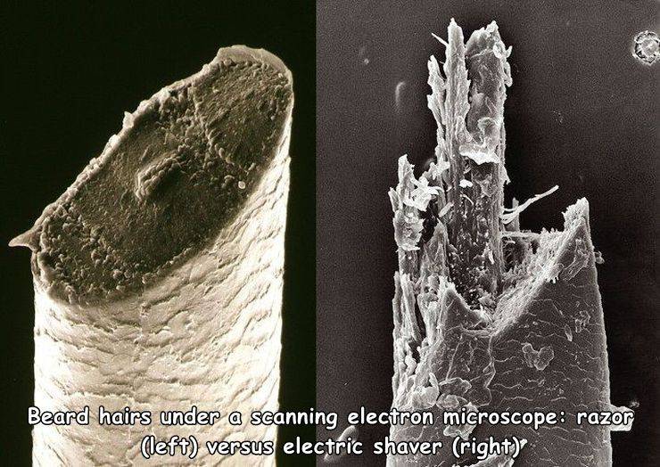beard hair under microscope - Beard hairs under a scanning electron microscope razor left versus electric shaver right