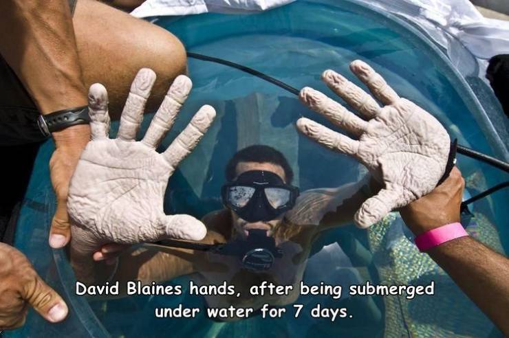 david blaine drowned alive - all David Blaines hands, after being submerged under water for 7 days.