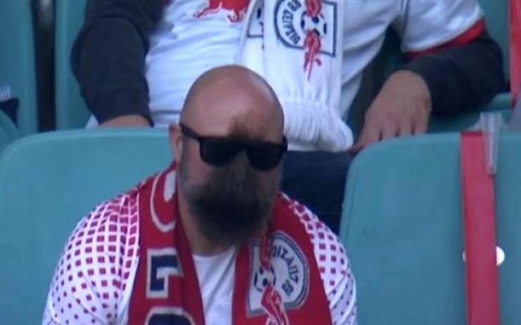 fascinating photos - bald guy with sunglasses on his head looks like a second face