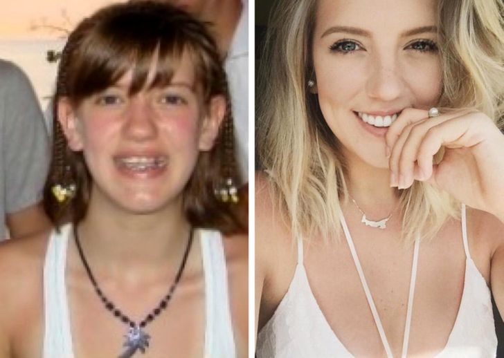 20 Awkward Kids Who Grew Up to Be Good Looking