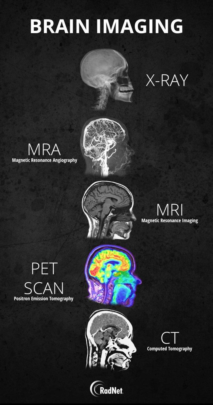 brain imaging techniques - Brain Imaging XRay Mra Magnetic Resonance Angiography Mri Magnetic Resonance Imaging Pet Scan Positron Emission Tomography Computed Tomography RadNet