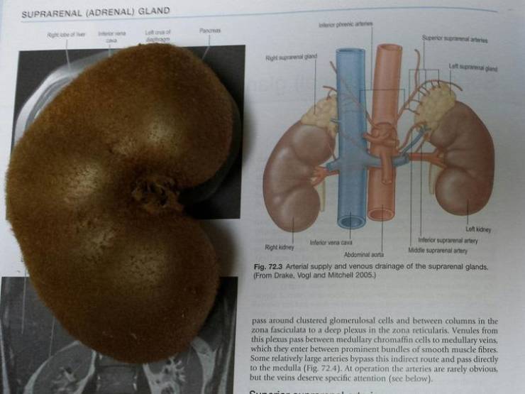 This kiwi looks like a kidney.”
