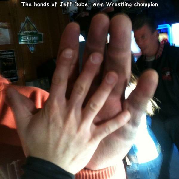 The hands of Jeff Dabe, Arm Wrestling champion Sum