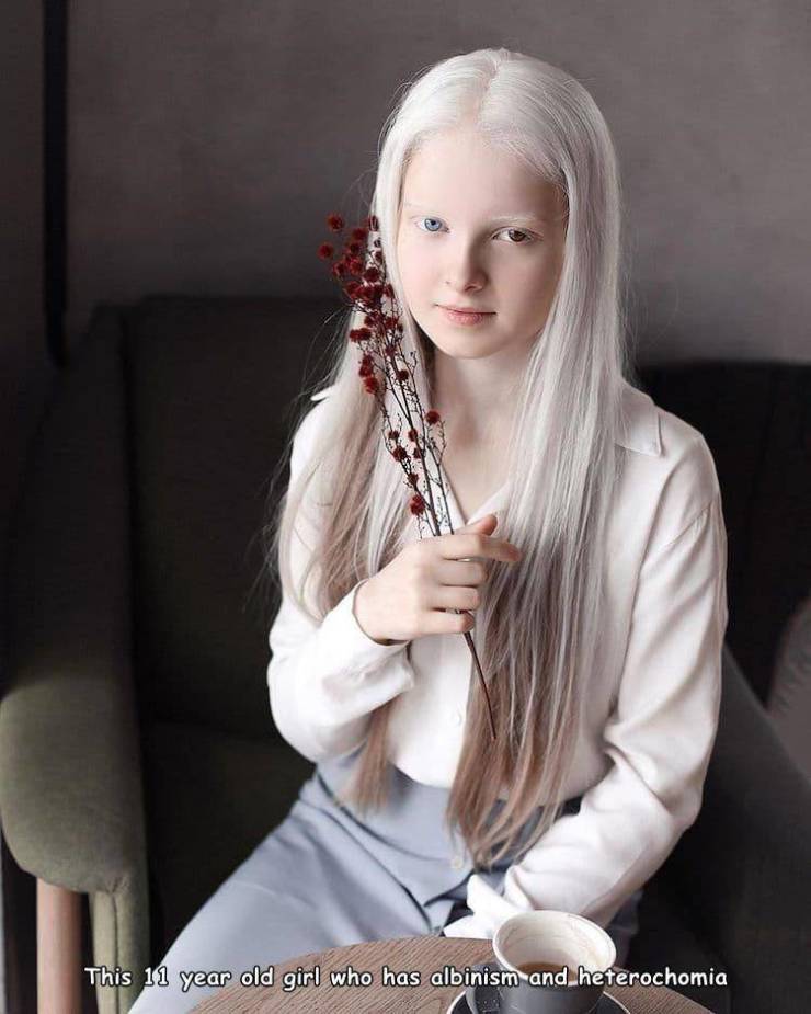 cool pics - amina ependieva - This 11 year old girl who has albinism and heterochomia