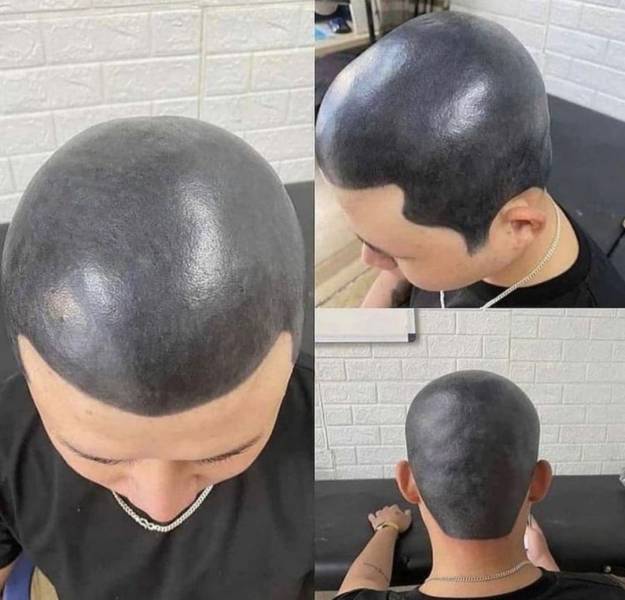 fun killer pics - funny photos - cleanest hairline