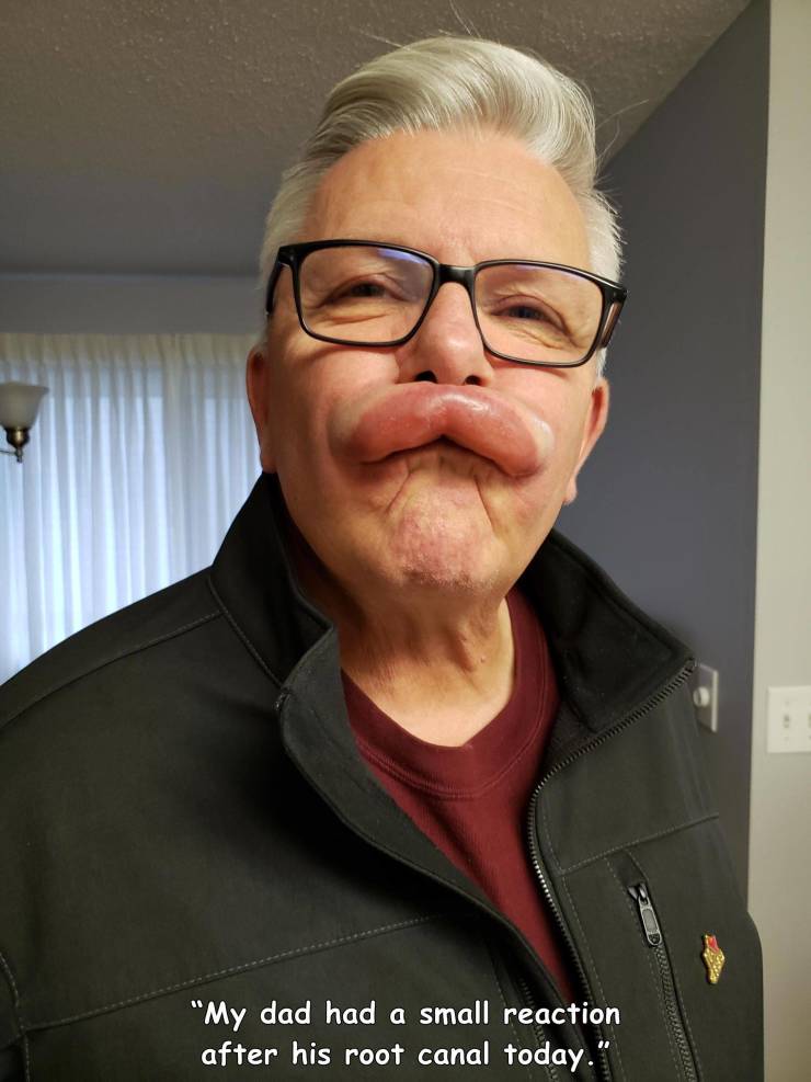 fun randoms - glasses - "My dad had a small reaction after his root canal today."
