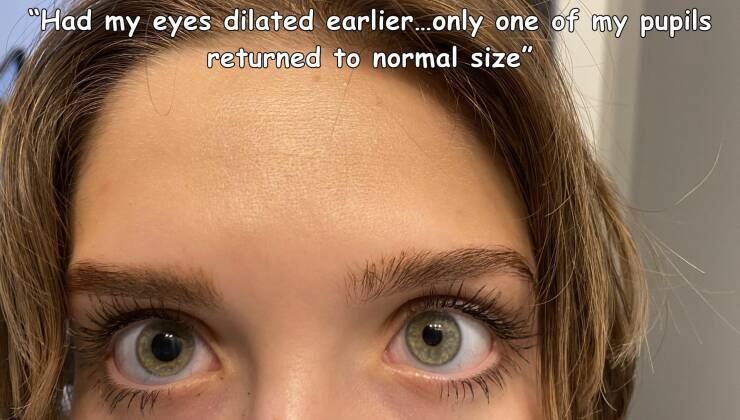 eyelash - Had my eyes dilated earlier....only one of my pupils returned to normal size"