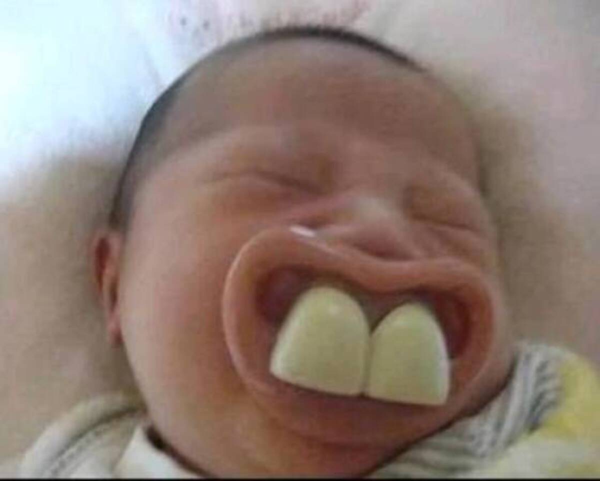 funny baby picture with big teeth