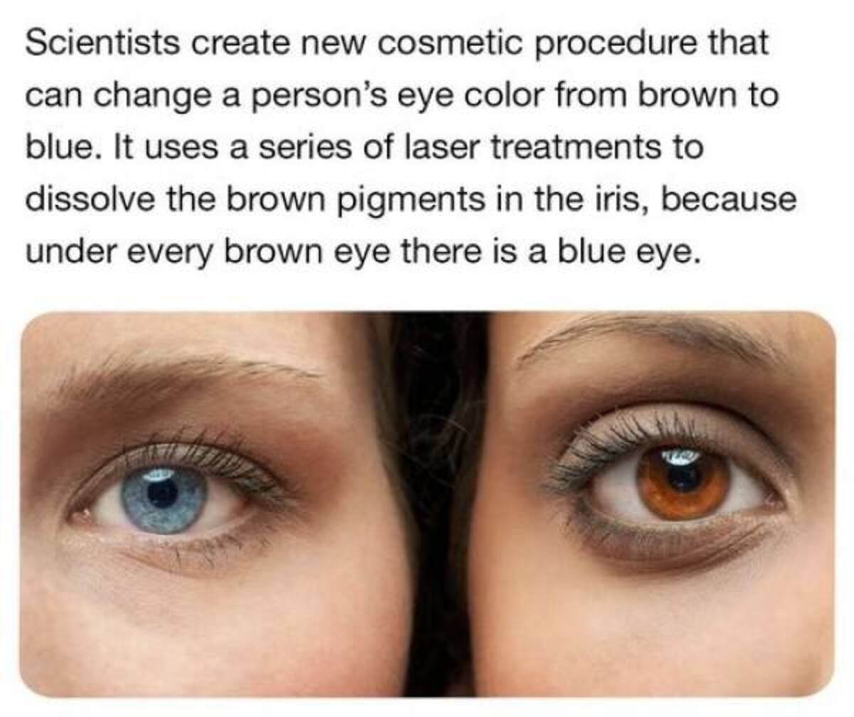 eye liner - Scientists create new cosmetic procedure that can change a person's eye color from brown to blue. It uses a series of laser treatments to dissolve the brown pigments in the iris, because under every brown eye there is a blue eye.