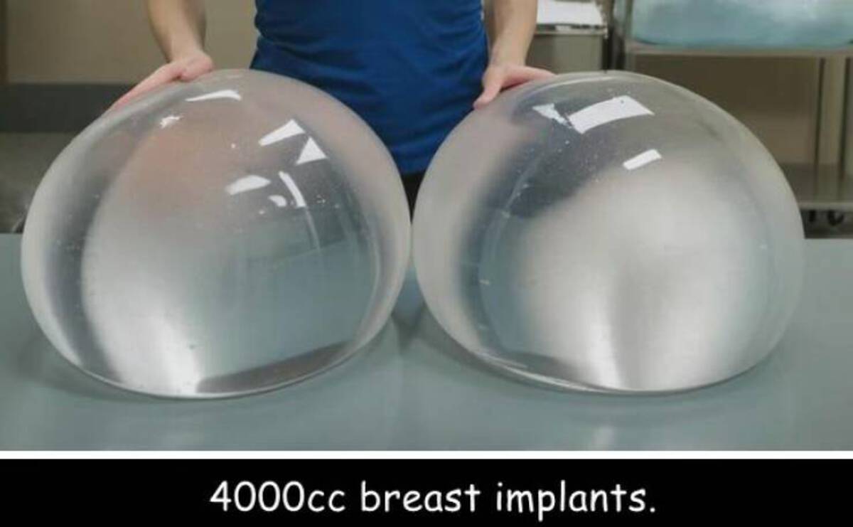 Breast implant - 4000cc breast implants.