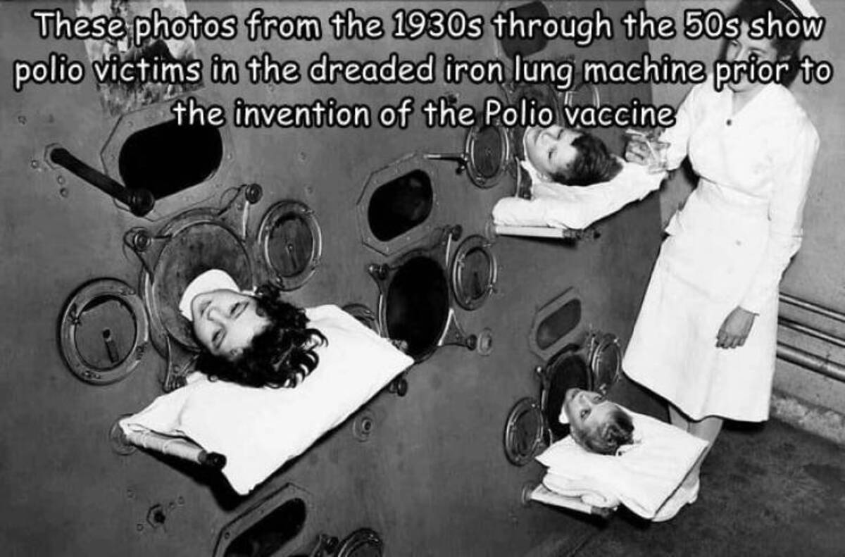 history of non invasive ventilation - These photos from the 1930s through the 50s show polio victims in the dreaded iron lung machine prior to the invention of the Polio vaccine