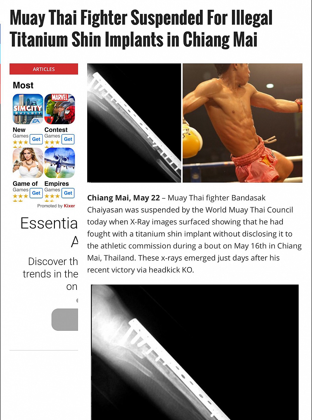 titanium shin implant - Muay Thai Fighter Suspended For Illegal Titanium Shin Implants in Chiang Mai Articles Most Marvel Simcity Buildit Sa New Games Contest Games Get Get Game of Empires Games Games Get Promoted by Kixer Essentia Chiang Mai, May 22 Muay