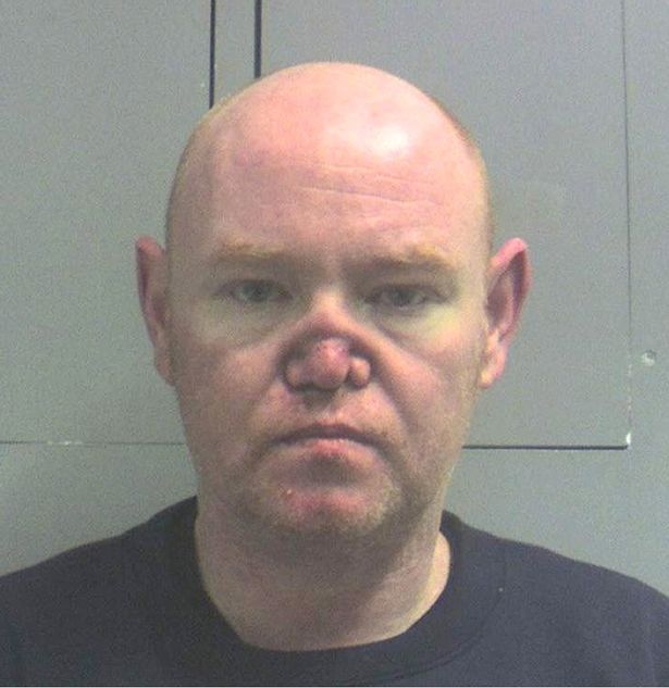 Millionaire property dealer James Brown from Glasgow, has a collapsed nose due to years of cocaine addiction,is jailed after police find drugs stash in the folding roof of his Bentley
