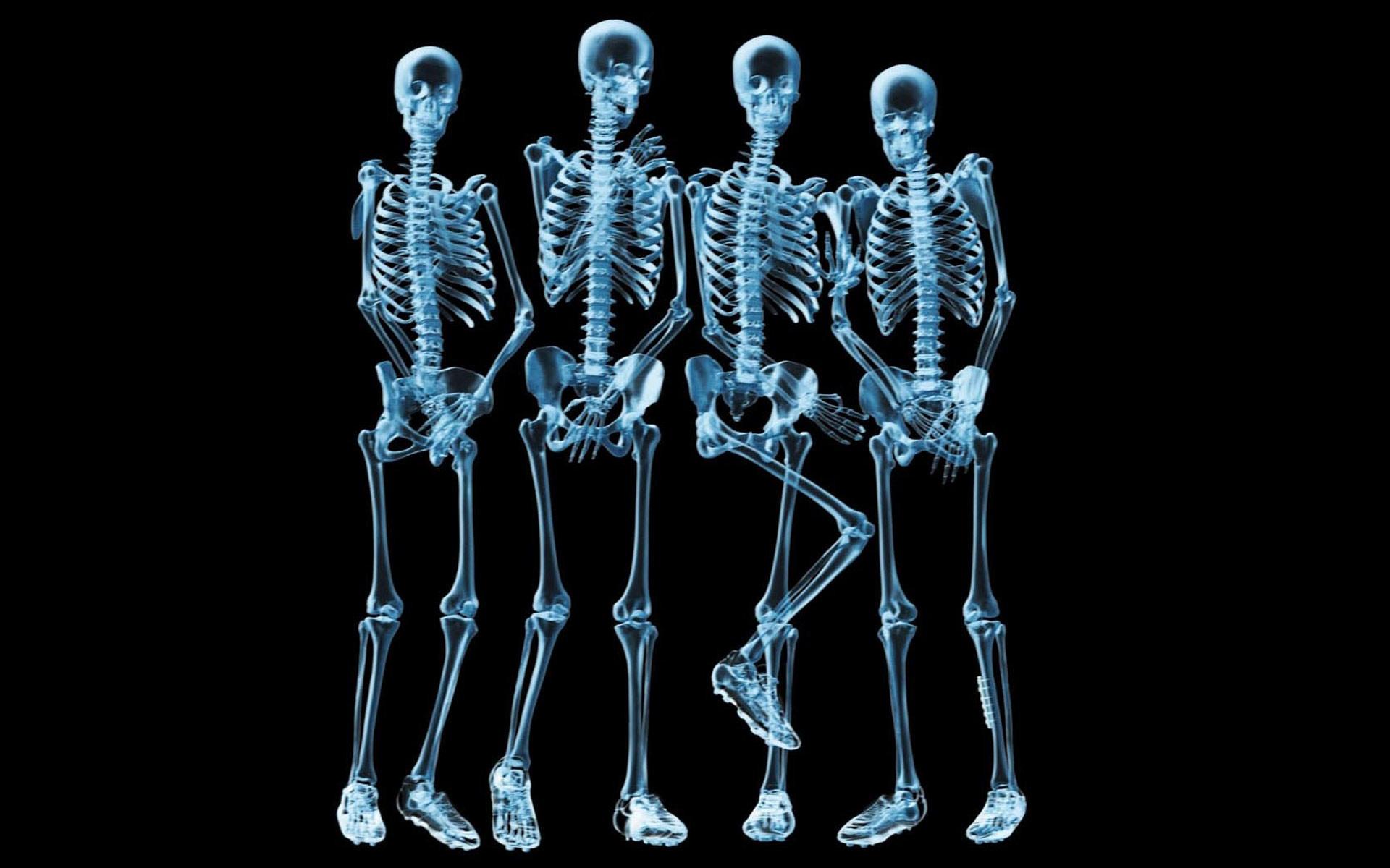 bizarre skeleton xray - 0