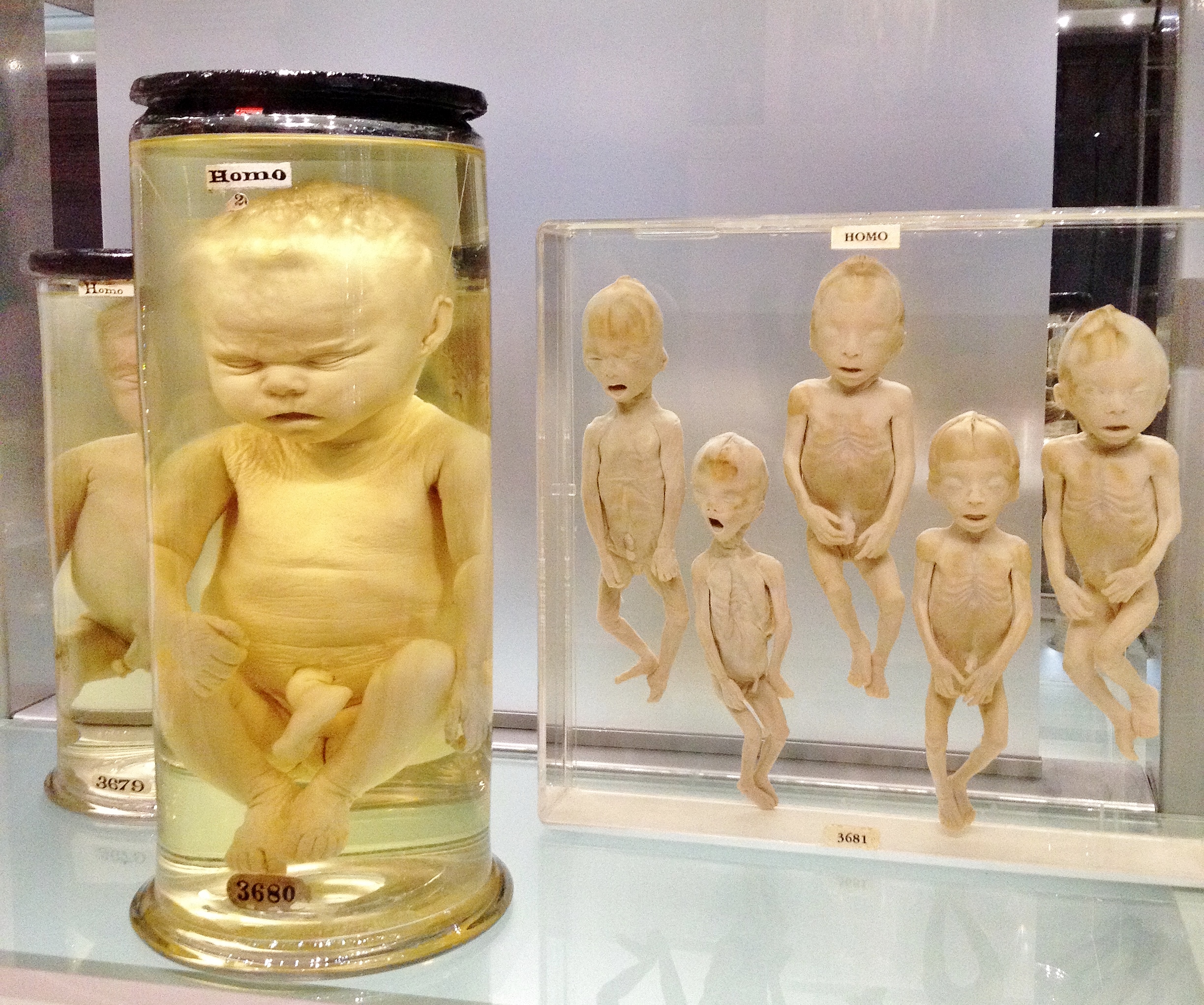 hunterian museum body parts - 3075 3680