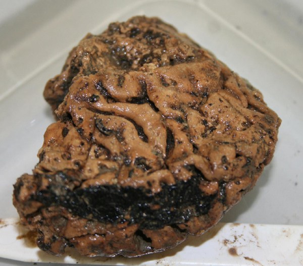 2,600-Year-Old Human Brain