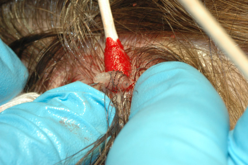 Botfly inside head