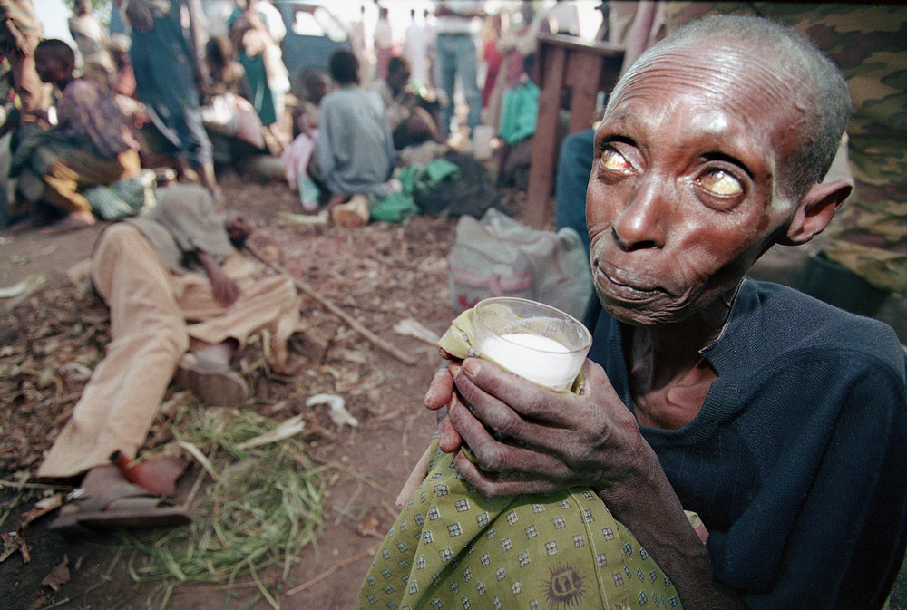 A starving woman sips milk at a makeshift health clinic in Ruhango, 30 miles southwest of Kigali, Rwanda, June 6, 1994