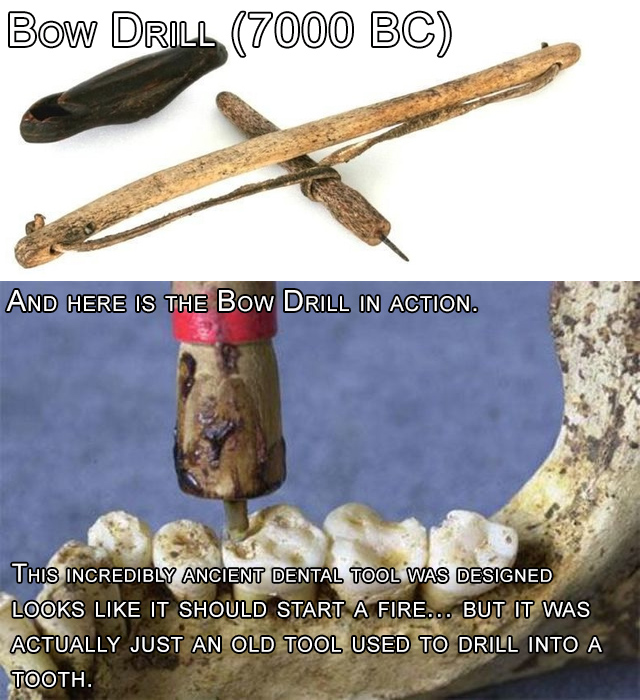 Ancient Dental Tools