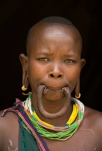 Woman With The World's Biggest Lip Disc
