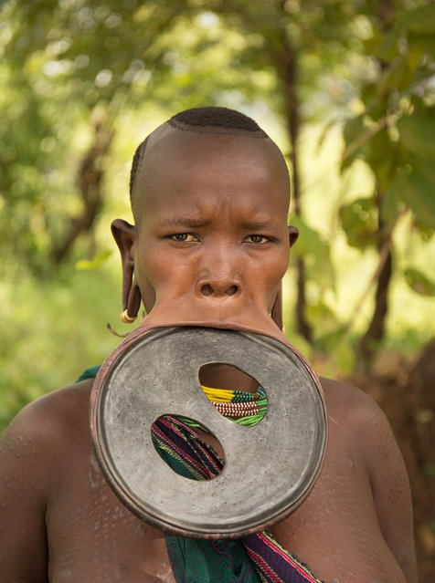 Woman With The World's Biggest Lip Disc