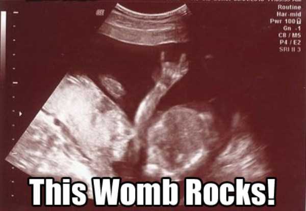 Funny Things Detected By Ultrasound