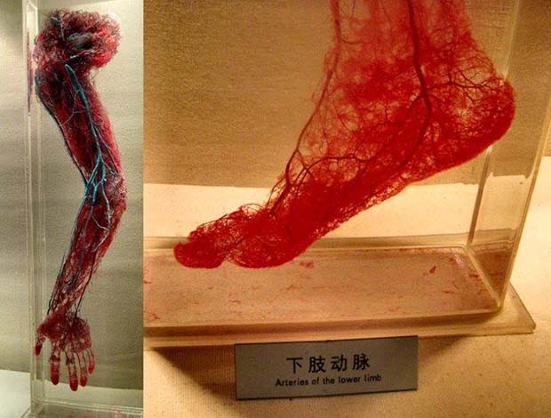 Human Blood Vessels (Arteries of the Hand and the Lower Limb)