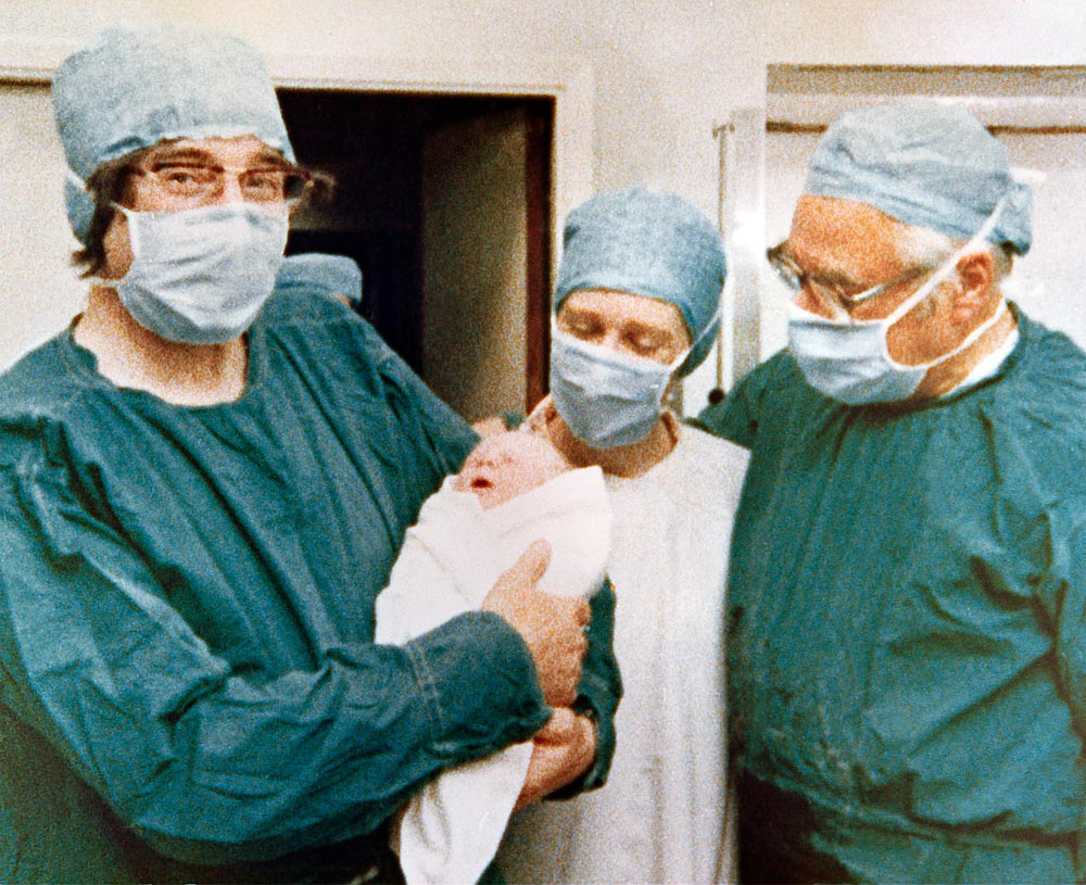 1978 Louise Brown, first "test-tube baby," born healthy