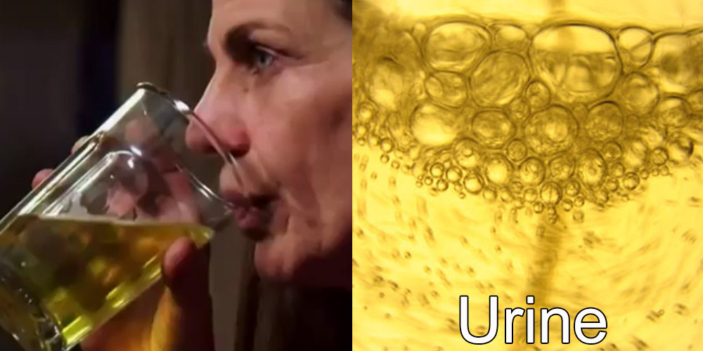 Addicted to Drinking Urine: Carrie is a 53-year-old woman who's suffering from cancer. Instaed of trying chemotherapy, Carrie is trying something completely different, drinking her own urine.