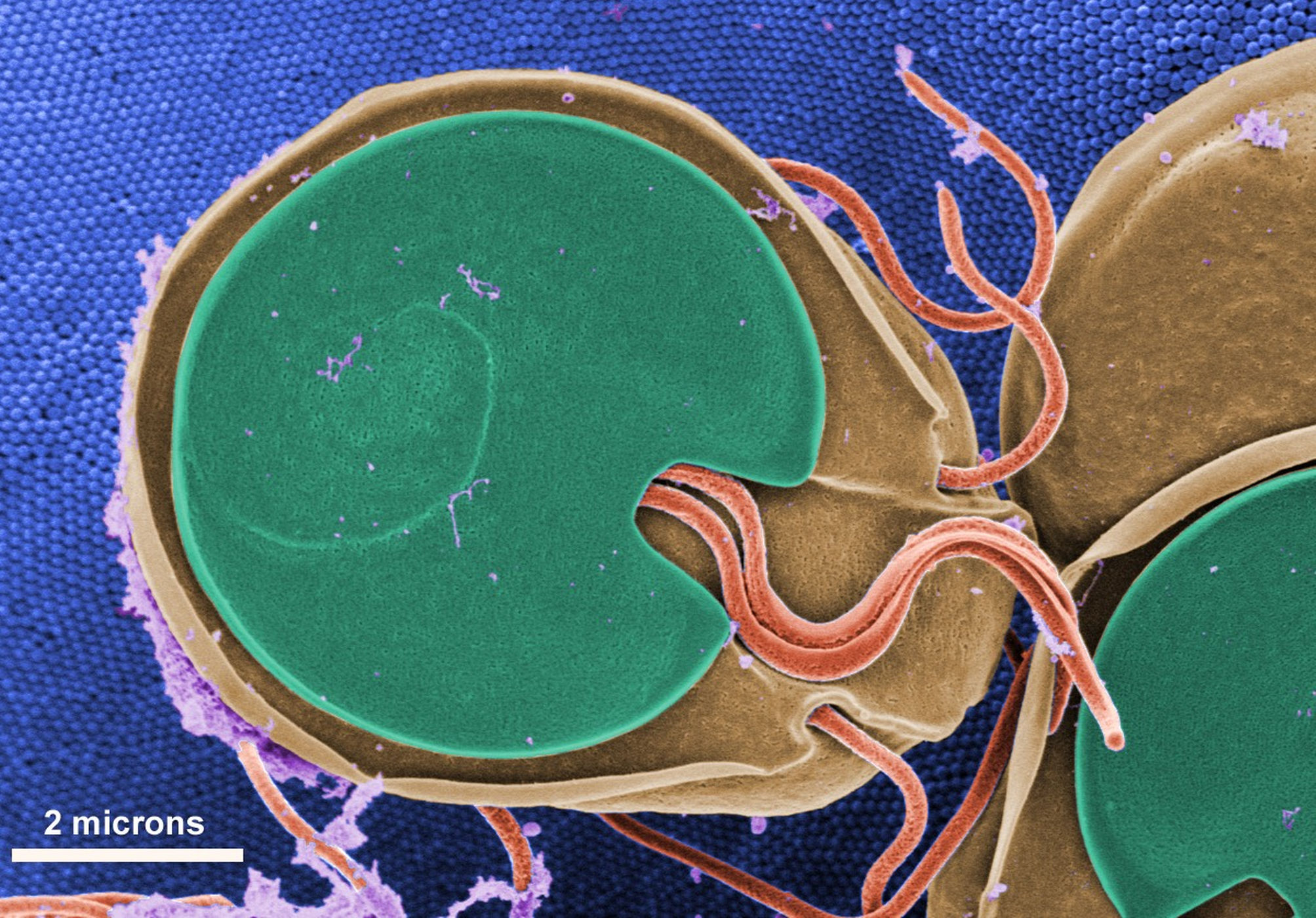 A human parasite seen under a microscope.