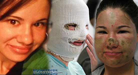 Botched Plastic Surgery