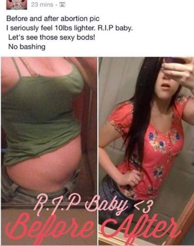 Wednesday meme with before and after pics of an abortion