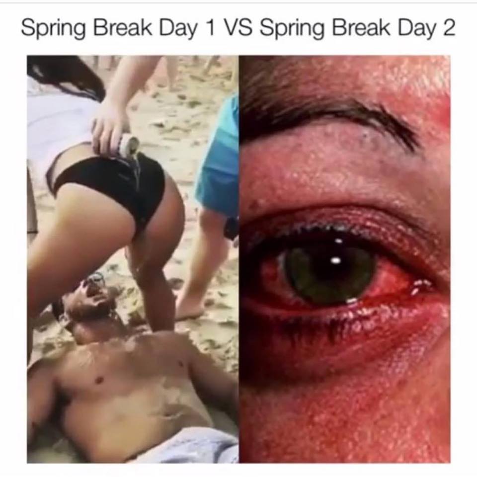 eye - Spring Break Day 1 Vs Spring Break Day 2