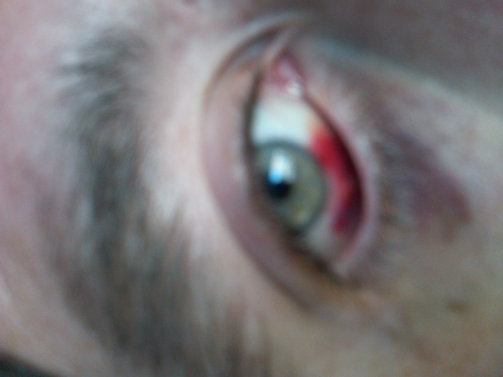 Passed out with a needle beside me on the bed  fell on it. Right in the eyeball. 