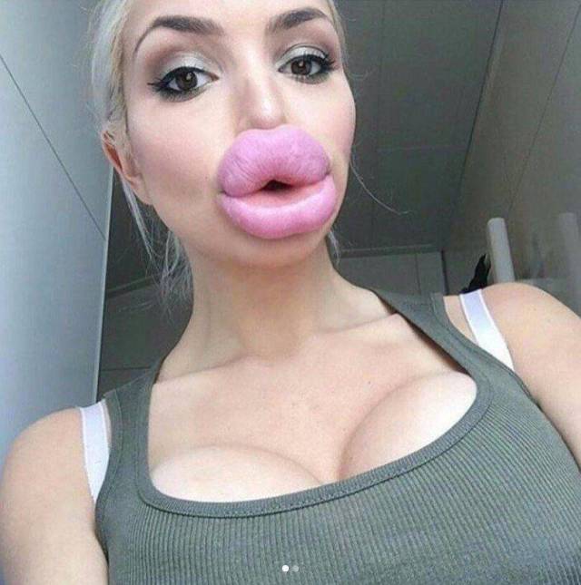 funny picture of fat lips
