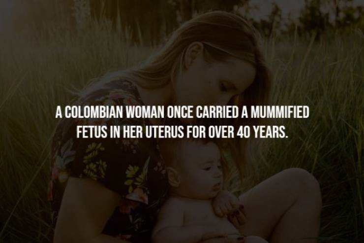 girl - A Colombian Woman Once Carried A Mummified Fetus In Her Uterus For Over 40 Years.