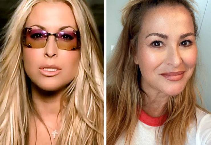 Anastacia.Few people know, but her hits “Left Outside Alone” and “Sick and Tired” were written after Anastacia beat breast cancer. The disease returned to her in 2013. But she managed to beat it for a second time and continued to make music. In 2017, she released her last album, and in 2019 she took part in a musical.