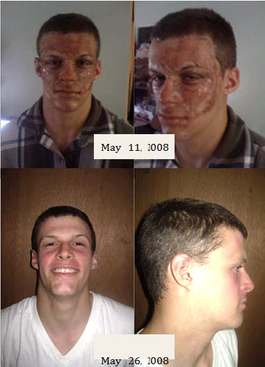 shaklee before and after -