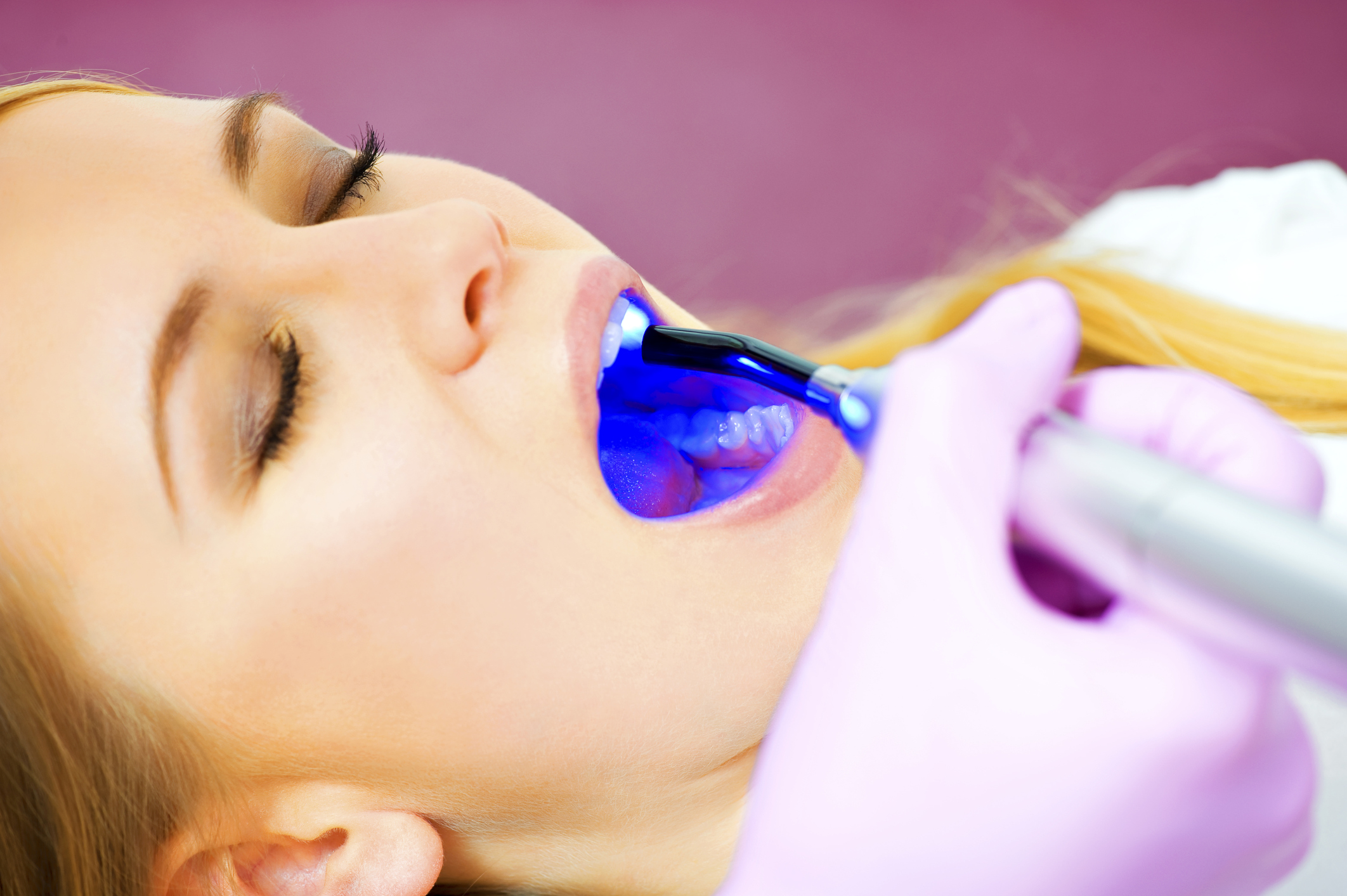 laser treatment for teeth