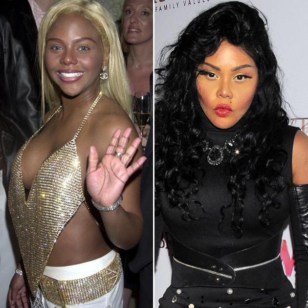lil kim before surgery