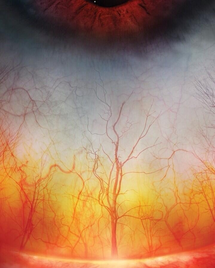 Blood vessels in the eye look like a terrifying forest.