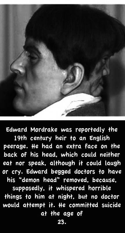 creepy man with demon face on back of head - Edward Mordrake was reportedly the 19th century heir to an English peerage. He had an extra face on the back of his head, which could neither eat nor speak, although it could laugh or cry. Edward begged doctors