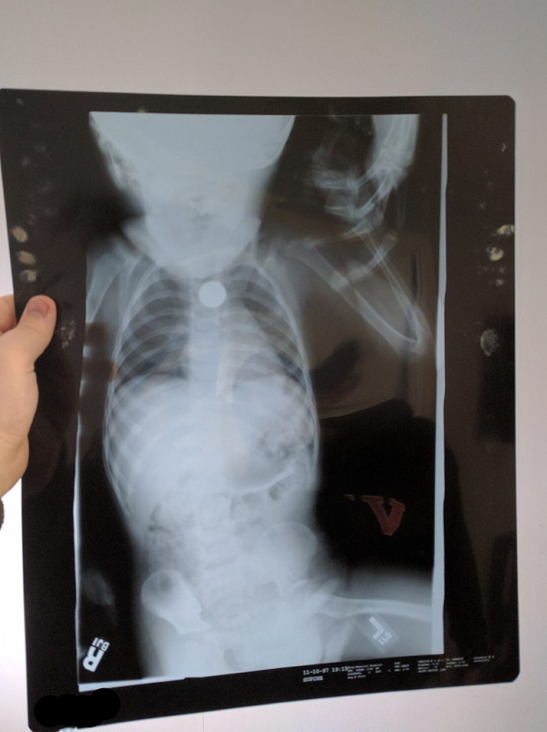 my x ray