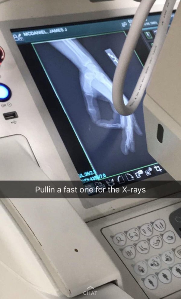 pulling a fast one meme - B Mcoanel, James J Dro Sal352. 01435 1.0 Pullin a fast one for the Xrays 000 Chat