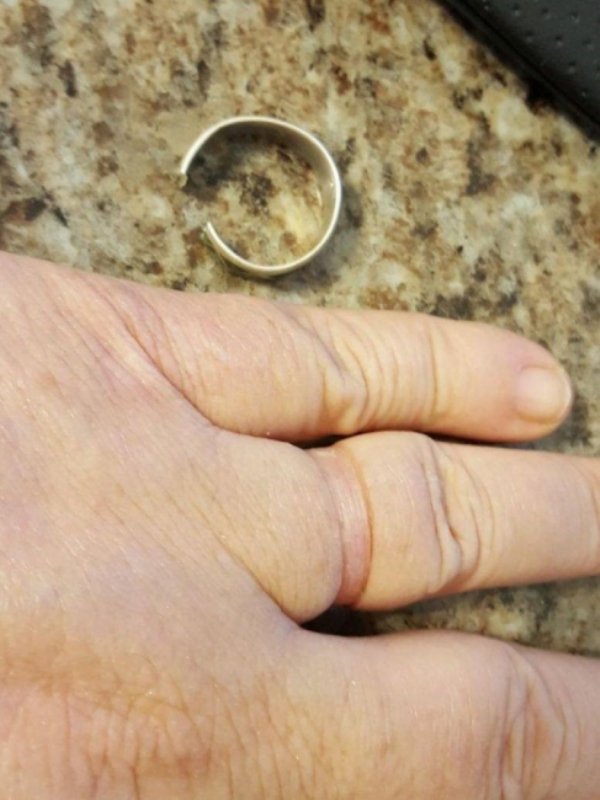 taking ring off for first time